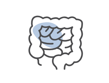 cancer colon