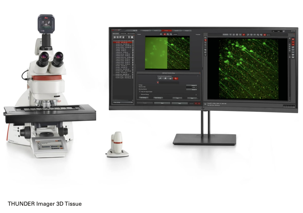 microscope financement recherche contre le cancer