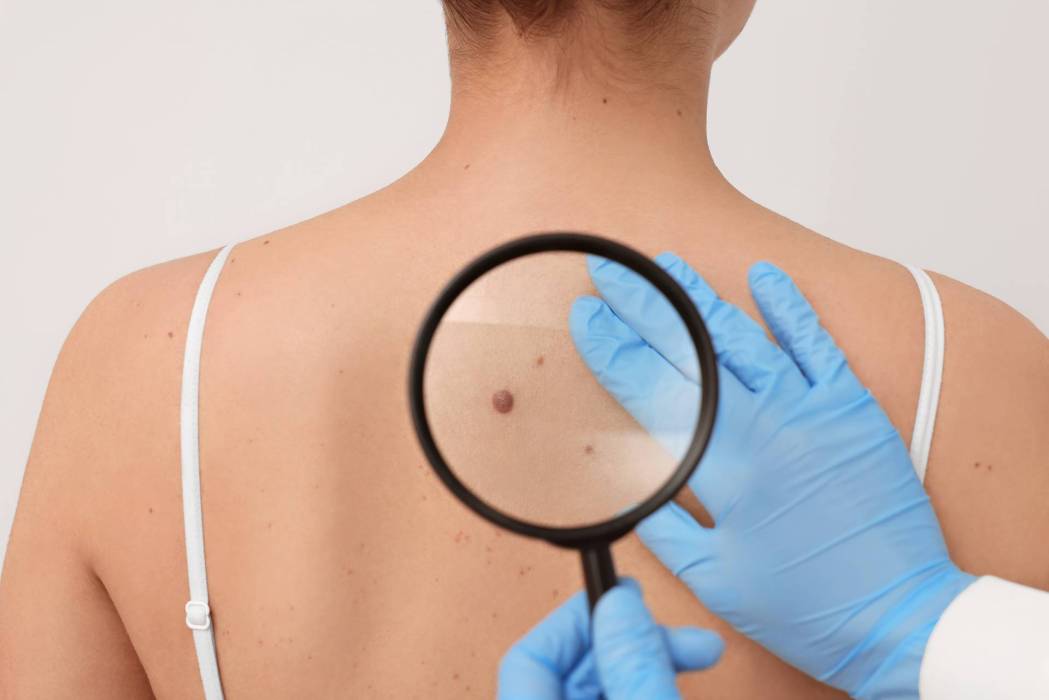 dermatologue loupe patient