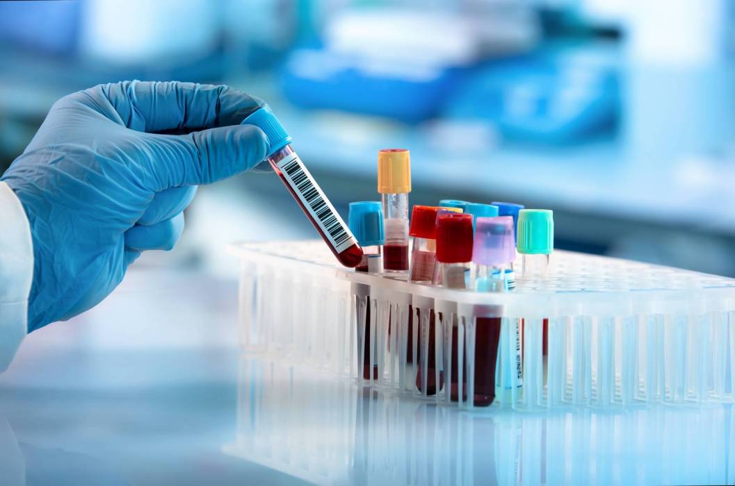 tubes laboratoire recherche