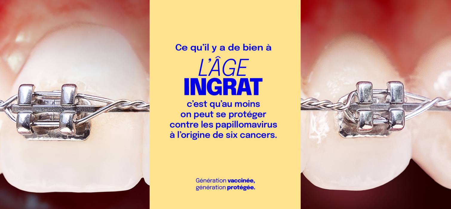L'âge ingrat