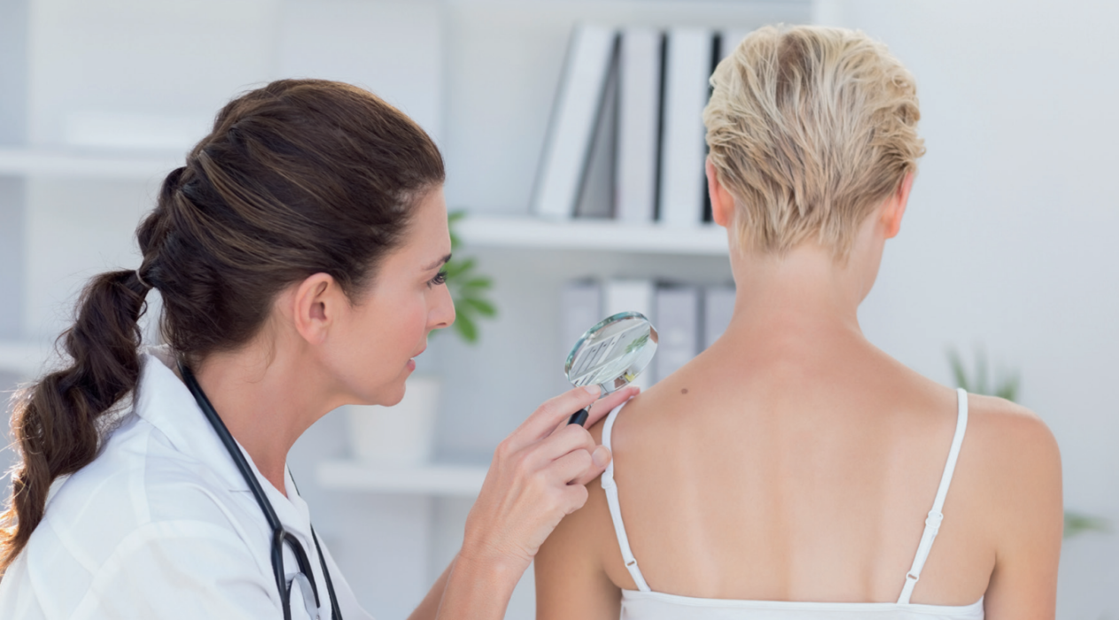 Visuel cancer de la peau