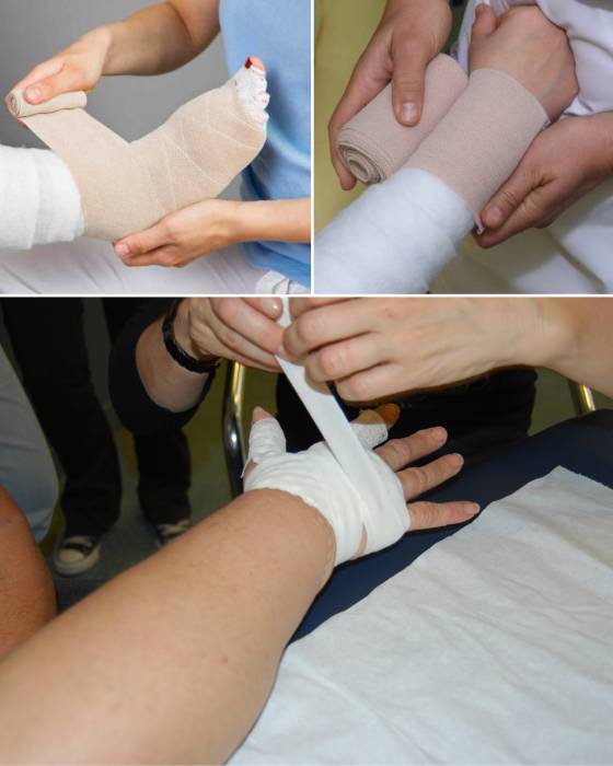 compression lymphoedeme