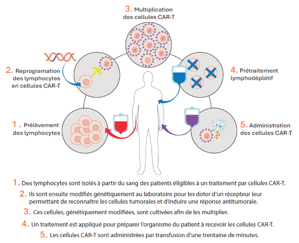 Schéma cellules CAR-T
