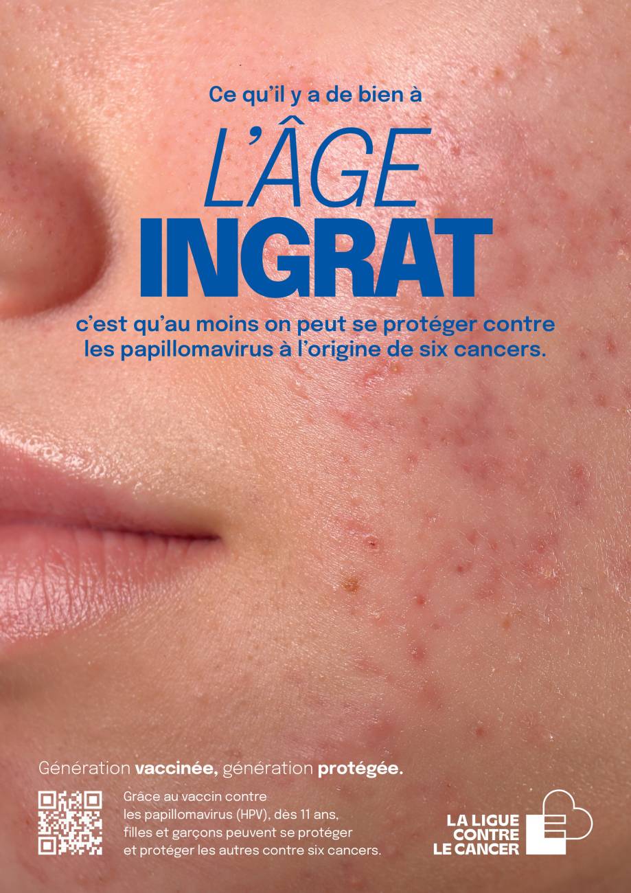 l'âge ingrat acné