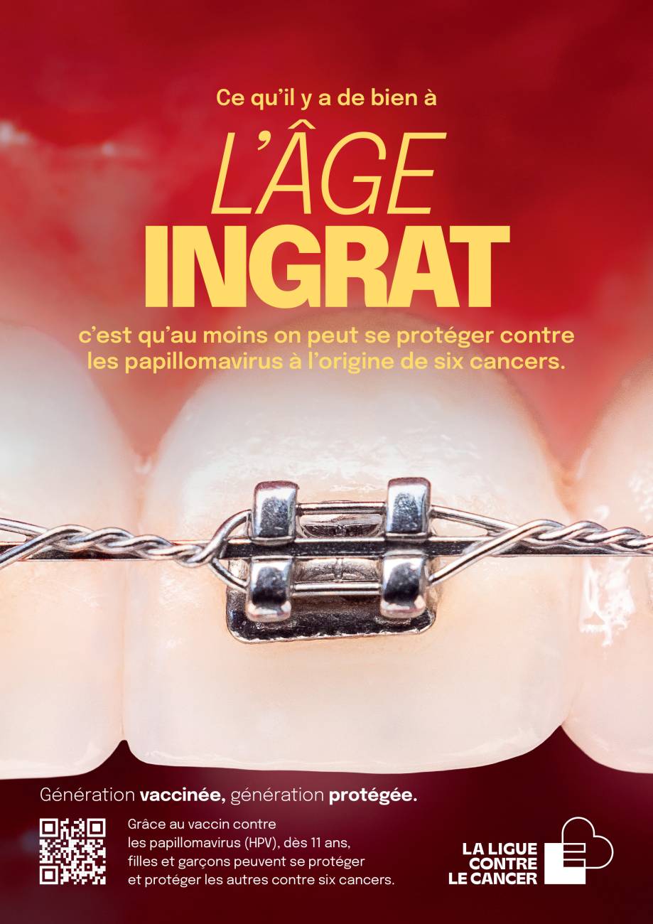 l'âge ingrat bague