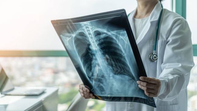 Cancer : la France mauvaise élève de la prévention ?