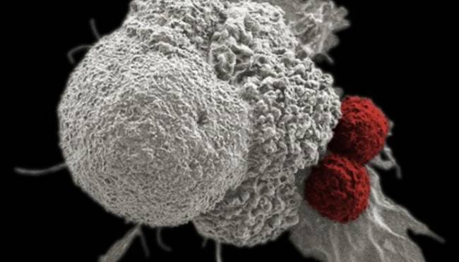 Cellules immunitaires (rouge) attaquant une cellule cancéreuse (NCI /DCC Baylor college of medicine)