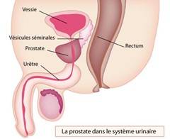 prostate