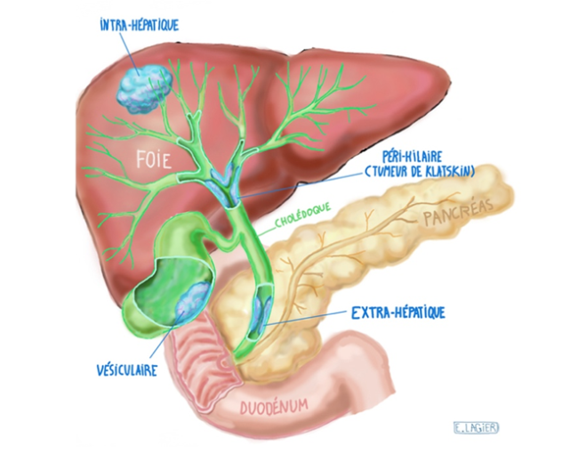 Cancer du foie | Ligue contre le cancer