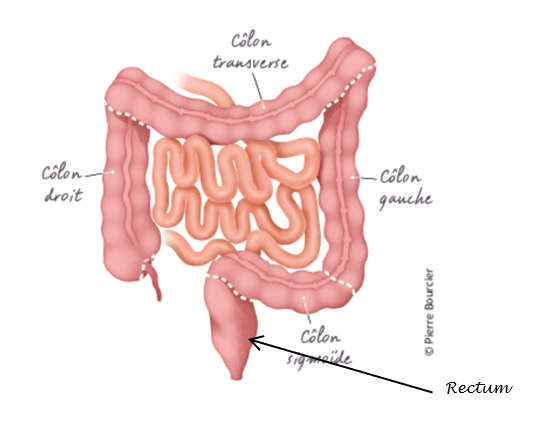 Cancer colorectal | Ligue contre le cancer